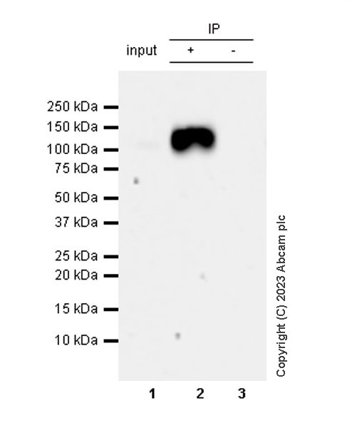 Immunoprecipitation - Anti-ACE2 antibody [RM1070] - BSA and Azide free (AB314772), expandable thumbnail