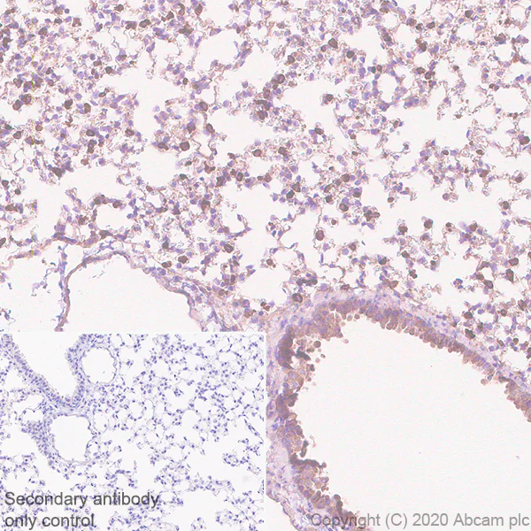 Immunohistochemistry (Formalin/PFA-fixed paraffin-embedded sections) - Anti-Acetyl Coenzyme A carboxylase alpha antibody [EPR23235-147] (AB269273)