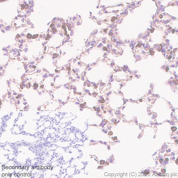 Immunohistochemistry (Formalin/PFA-fixed paraffin-embedded sections) - Anti-Acetyl Coenzyme A carboxylase alpha antibody [EPR23235-147] (AB269273)