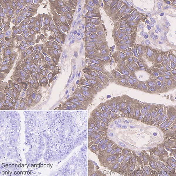 Immunohistochemistry (Formalin/PFA-fixed paraffin-embedded sections) - Anti-Acetyl Coenzyme A carboxylase alpha antibody [EPR23235-47] (ab269272), expandable thumbnail