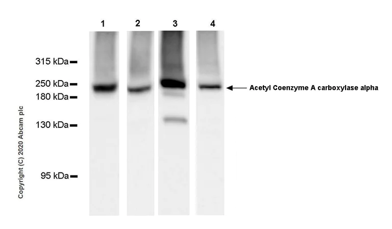 Western blot - Anti-Acetyl Coenzyme A carboxylase alpha antibody [EPR23235-47] (AB269272)