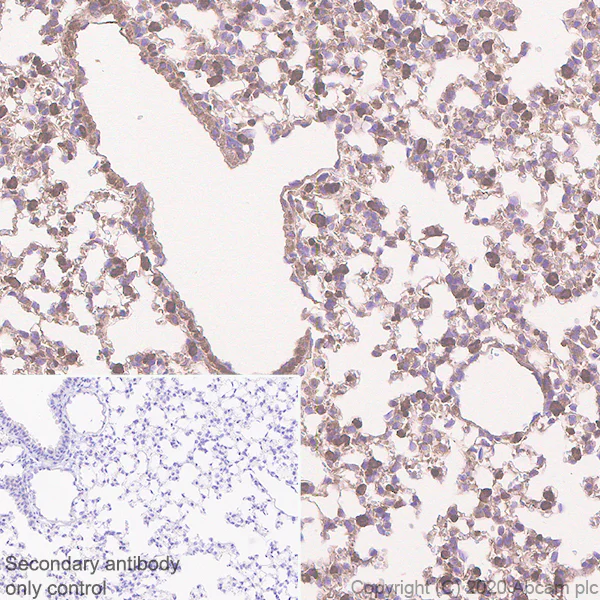 Immunohistochemistry (Formalin/PFA-fixed paraffin-embedded sections) - Anti-Acetyl Coenzyme A carboxylase alpha antibody [EPR23235-47] - BSA and Azide free (AB272703)