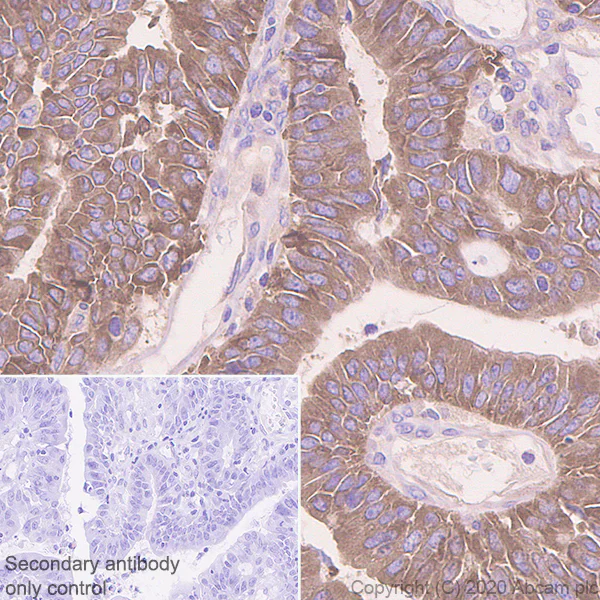 Immunohistochemistry (Formalin/PFA-fixed paraffin-embedded sections) - Anti-Acetyl Coenzyme A carboxylase alpha antibody [EPR23235-47] - BSA and Azide free (AB272703)