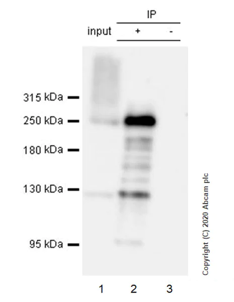 Immunoprecipitation - Anti-Acetyl Coenzyme A carboxylase alpha antibody [EPR23235-47] - BSA and Azide free (AB272703)
