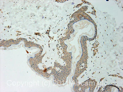 Immunohistochemistry (Formalin/PFA-fixed paraffin-embedded sections) - Anti-Acetyl Coenzyme A Carboxylase antibody (AB72046)
