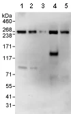 Western blot - Anti-Acetyl Coenzyme A Carboxylase antibody (AB72046)