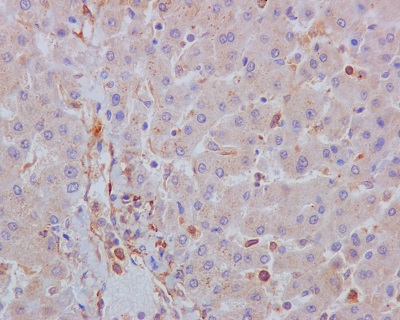Immunohistochemistry (Formalin/PFA-fixed paraffin-embedded sections) - Anti-Acetyl Coenzyme A Carboxylase antibody [EP687Y] (ab45174), expandable thumbnail