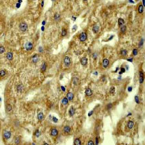 Immunohistochemistry (Formalin/PFA-fixed paraffin-embedded sections) - Anti-Acetyl Coenzyme A Carboxylase antibody [EP687Y] (AB45174)
