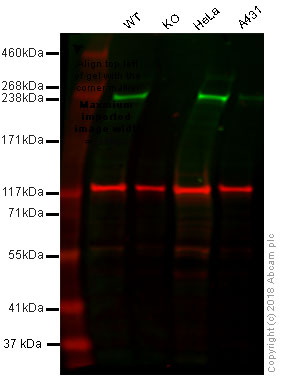 Western blot - Anti-Acetyl Coenzyme A Carboxylase antibody [EP687Y] (AB45174), expandable thumbnail