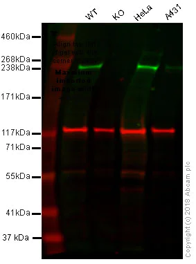 Western blot - Anti-Acetyl Coenzyme A Carboxylase antibody [EP687Y] (AB45174)