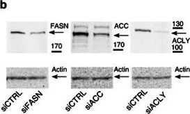 Western blot - Anti-Acetyl Coenzyme A Carboxylase antibody [EP687Y] (ab45174), expandable thumbnail