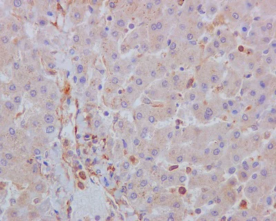 Immunohistochemistry (Formalin/PFA-fixed paraffin-embedded sections) - Anti-Acetyl Coenzyme A Carboxylase antibody [EP687Y] - BSA and Azide free (AB173584)