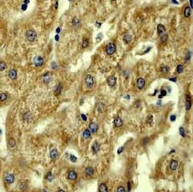 Immunohistochemistry (Formalin/PFA-fixed paraffin-embedded sections) - Anti-Acetyl Coenzyme A Carboxylase antibody [EP687Y] - BSA and Azide free (AB173584)