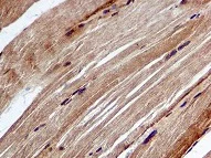 Immunohistochemistry (Formalin/PFA-fixed paraffin-embedded sections) - Anti-Acetyl Coenzyme A Carboxylase antibody [EPR4971] (AB109368)