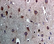 Immunohistochemistry (Formalin/PFA-fixed paraffin-embedded sections) - Anti-Acetyl Coenzyme A Carboxylase antibody [EPR4971] (AB109368)