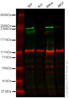 Western blot - Anti-Acetyl Coenzyme A Carboxylase antibody [EPR4971] (AB109368)