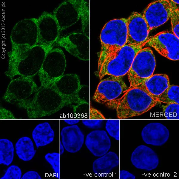 Immunocytochemistry/ Immunofluorescence - Anti-Acetyl Coenzyme A Carboxylase antibody [EPR4971] - BSA and Azide free (AB231681)