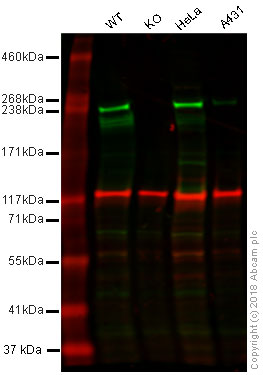 Western blot - Anti-Acetyl Coenzyme A Carboxylase antibody [EPR4971] - BSA and Azide free (AB231681)