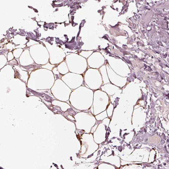 Immunohistochemistry (Formalin/PFA-fixed paraffin-embedded sections) - Anti-Acetyl Coenzyme A Carboxylase beta antibody (AB223781)
