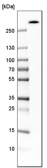 Western blot - Anti-Acetyl Coenzyme A Carboxylase beta antibody (AB223781)