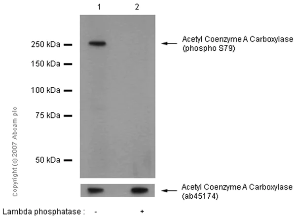 Western blot - Anti-Acetyl Coenzyme A Carboxylase (phospho S79) antibody [EP1885Y] (AB68191)