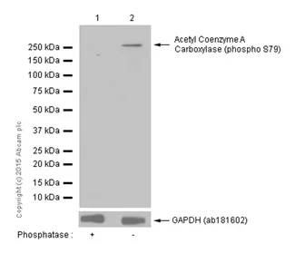 Western blot - Anti-Acetyl Coenzyme A Carboxylase (phospho S79) antibody [EP1885Y] (AB68191)