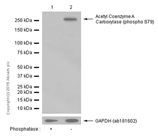 Western blot - Anti-Acetyl Coenzyme A Carboxylase (phospho S79) antibody [EP1885Y] (AB68191)