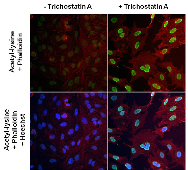 Immunocytochemistry/ Immunofluorescence - Anti-acetyl Lysine antibody [1C6] (AB22550)