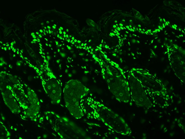 Immunohistochemistry (Formalin/PFA-fixed paraffin-embedded sections) - Anti-acetyl Lysine antibody [7F8] (AB61384), expandable thumbnail