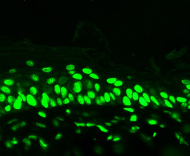 Immunohistochemistry (Frozen sections) - Anti-acetyl Lysine antibody [7F8] (AB61384), expandable thumbnail