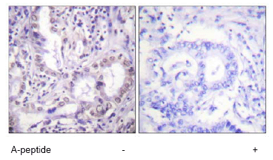 Immunohistochemistry (Formalin/PFA-fixed paraffin-embedded sections) - Anti-acetyl Lysine antibody (AB61257)