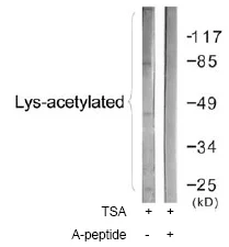 Western blot - Anti-acetyl Lysine antibody (AB61257)