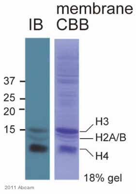 Western blot - Anti-acetyl Lysine antibody (AB61257)