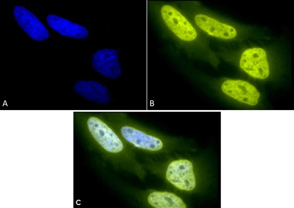Immunocytochemistry/ Immunofluorescence - Anti-acetyl Lysine antibody (AB80178)