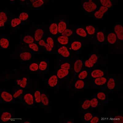 Immunocytochemistry/ Immunofluorescence - Anti-acetyl Lysine antibody (AB80178)