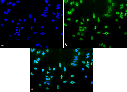 Immunocytochemistry/ Immunofluorescence - Anti-acetyl Lysine antibody (AB80178)
