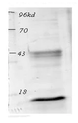 Western blot - Anti-acetyl Lysine antibody (AB80178)