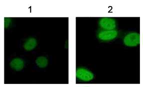 Immunocytochemistry/ Immunofluorescence - Anti-acetyl Lysine antibody - ChIP Grade (AB21623)