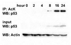 Immunoprecipitation - Anti-acetyl Lysine antibody - ChIP Grade (AB21623)