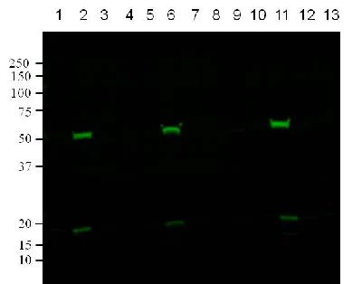 Western blot - Anti-acetyl Lysine antibody - ChIP Grade (AB21623)