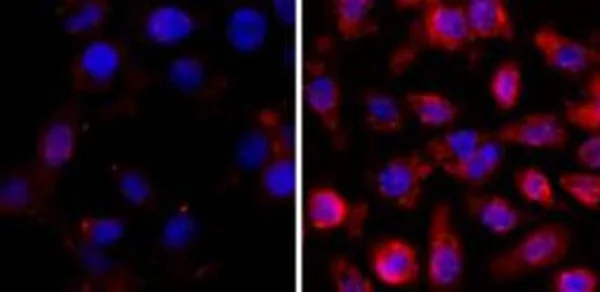 Immunocytochemistry/ Immunofluorescence - Anti-acetyl Lysine antibody [RM101] (AB190479)