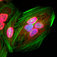 Immunocytochemistry/ Immunofluorescence - Anti-acetyl Lysine antibody [RM101] (AB190479)