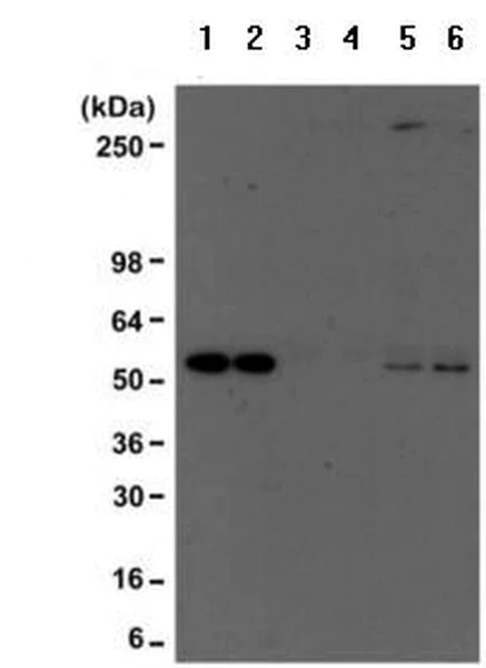 Immunoprecipitation - Anti-acetyl Lysine antibody [RM101] (AB190479)
