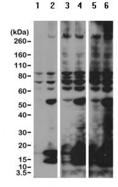 Western blot - Anti-acetyl Lysine antibody [RM101] (AB190479)