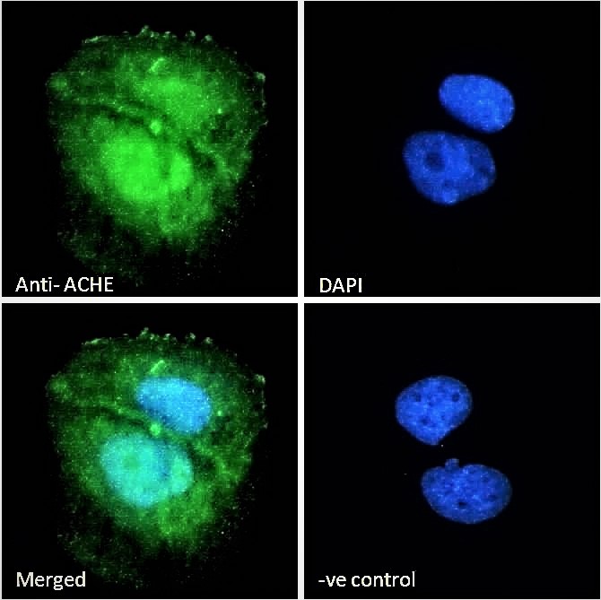 Immunocytochemistry/ Immunofluorescence - Anti-Acetylcholinesterase antibody (AB31276), expandable thumbnail