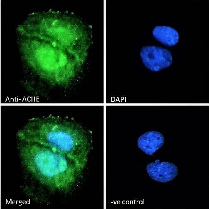 Immunocytochemistry/ Immunofluorescence - Anti-Acetylcholinesterase antibody (AB31276)