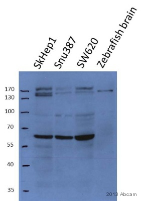 Western blot - Anti-Acetylcholinesterase antibody (AB31276), expandable thumbnail
