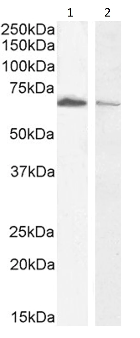 Western blot - Anti-Acetylcholinesterase antibody (AB31276)