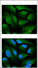 Anti-Acetylcholinesterase antibody (ab97299) | Abcam
