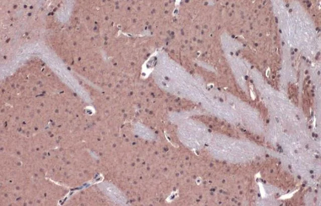 Immunohistochemistry (Formalin/PFA-fixed paraffin-embedded sections) - Anti-Acetylcholinesterase antibody (AB97299)